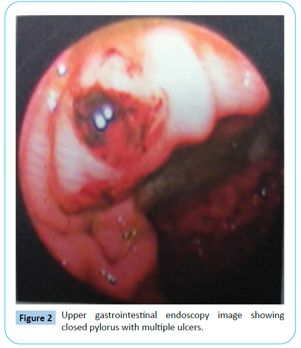 archives-medicine-gastrointestinal-endoscopy