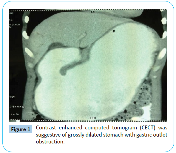 archives-medicine-grossly-dilated