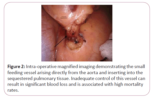 cancer-research-blood