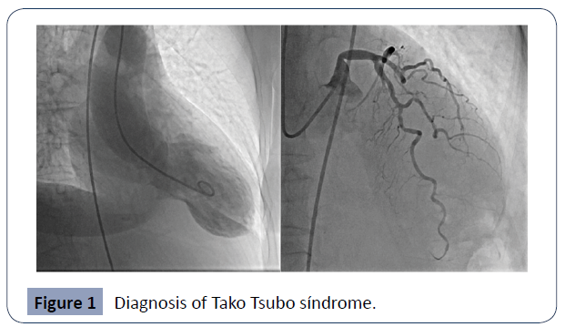 health-science-journal-Diagnosis