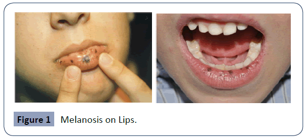 health-science-journal-Lips