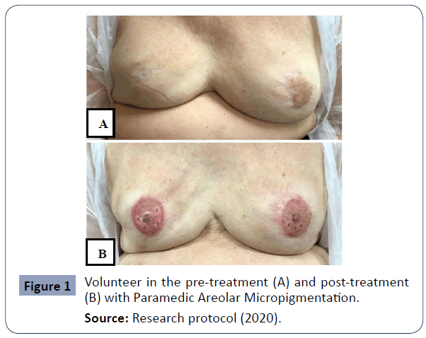 health-science-journal-Micropigmentation