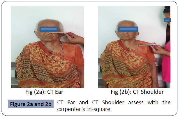 health-science-journal-Shoulder