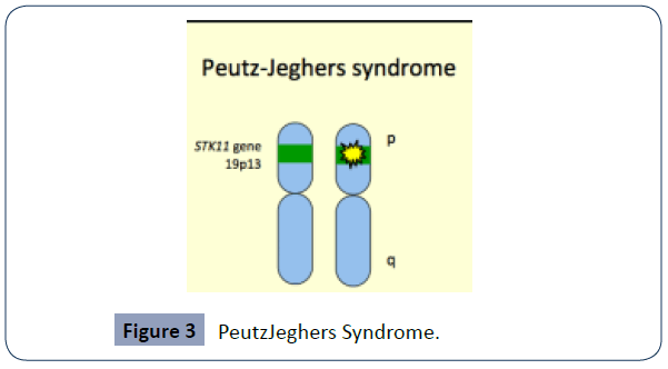 health-science-journal-Syndrome