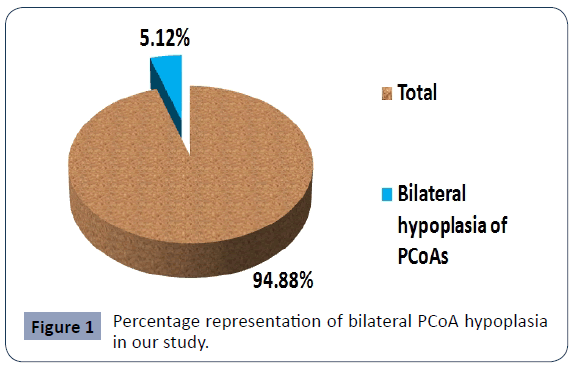 health-science-journal-hypoplasia