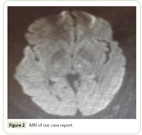 jneuro-case-report