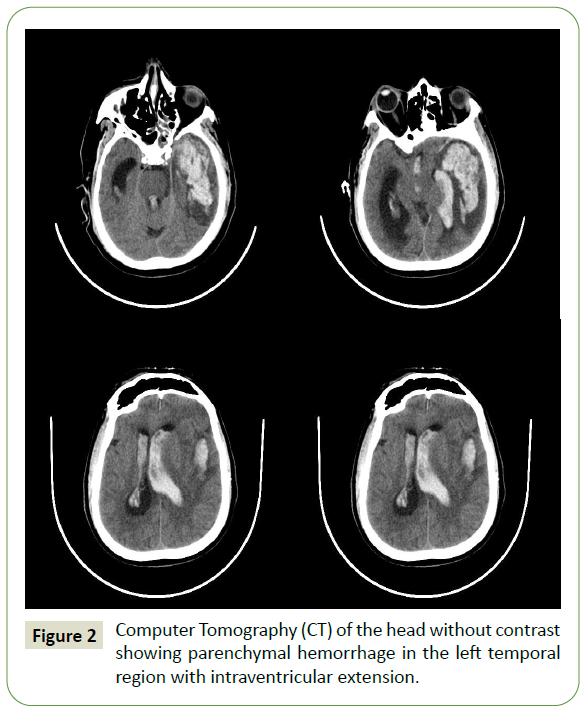 jneuro-computer-tomography