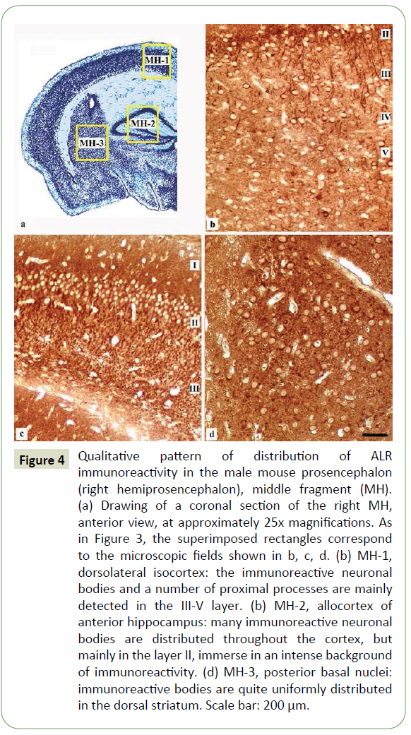 jneuro-coronal-section