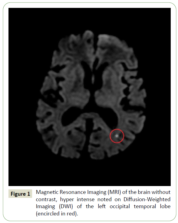 jneuro-magnetic-resonance