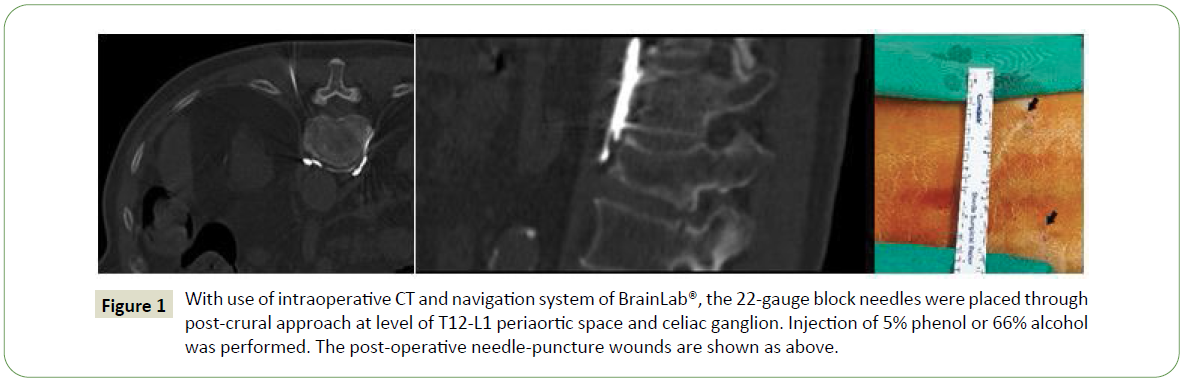 jneuro-navigation-system