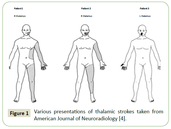 jneuro-various-presentations