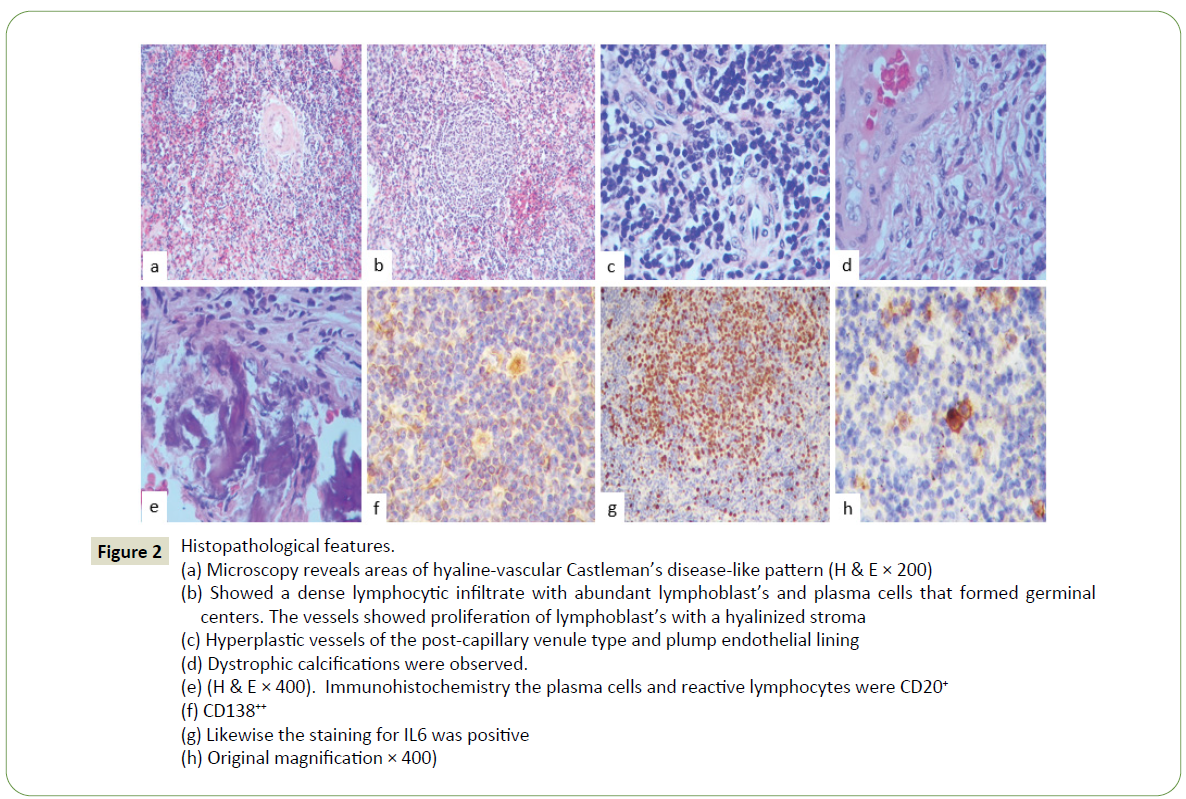 neurology-neuroscience-histopathological