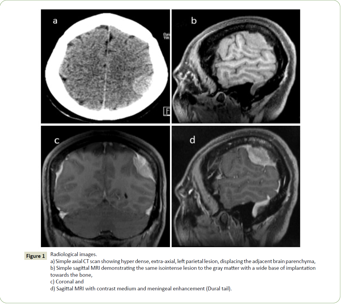 neurology-neuroscience-radiological