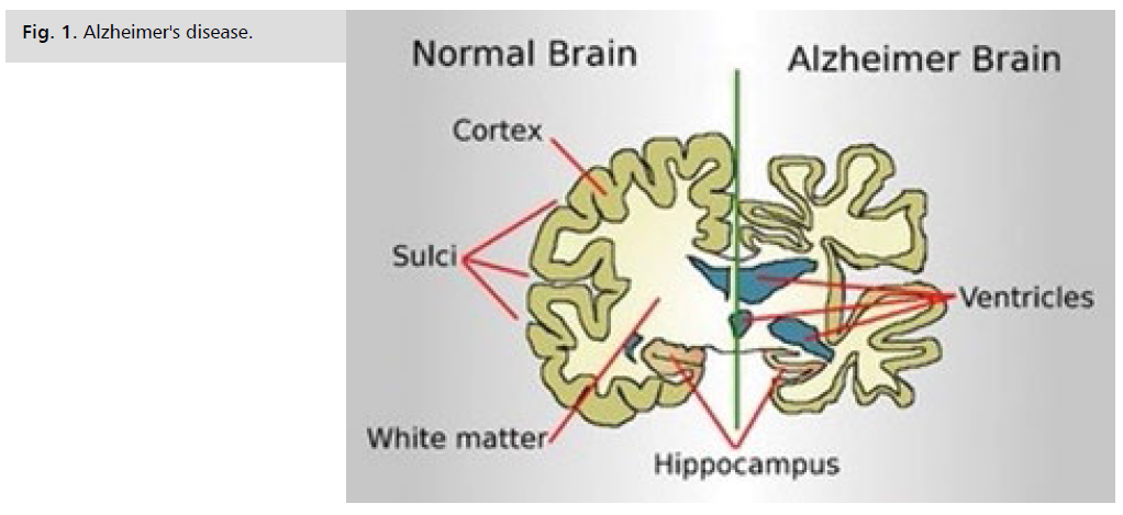 jneuro-disease