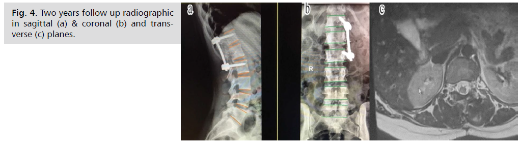 jneuro-radiographic