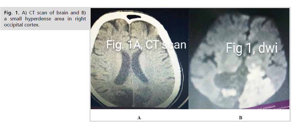 neurology-neuroscience-brain