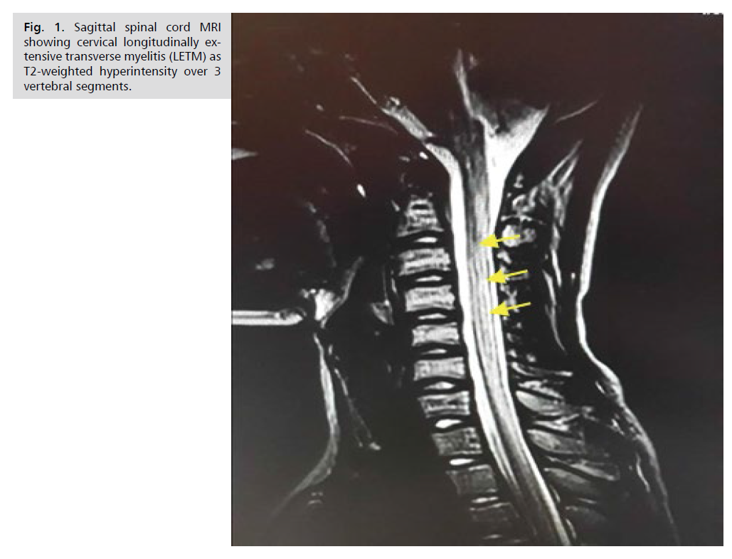 neurology-neuroscience-cervical-longitudinally