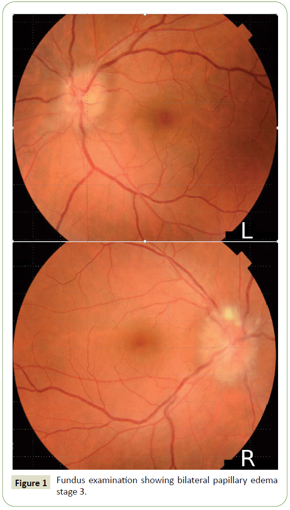 neurology-neuroscience-fundus