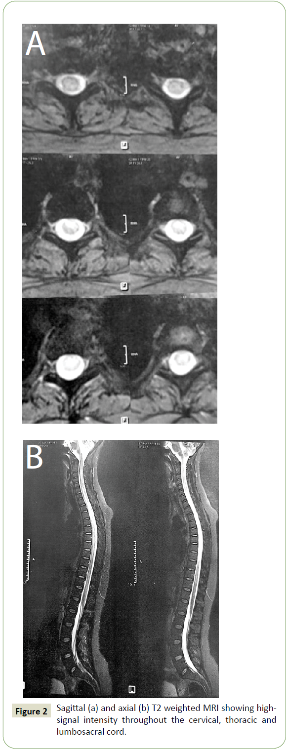 neurology-neuroscience-intensity