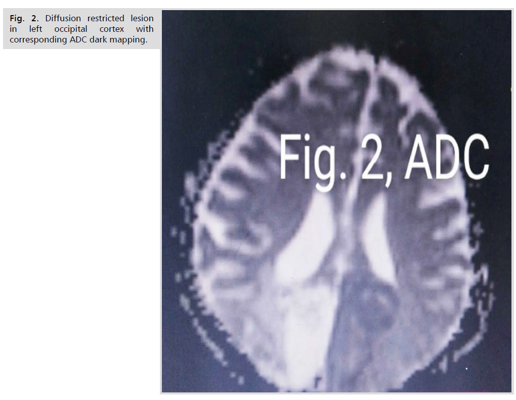 neurology-neuroscience-mapping