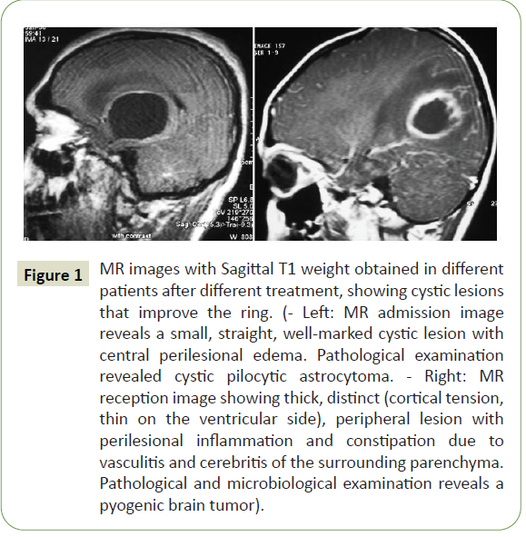 neurology-neuroscience-pathological