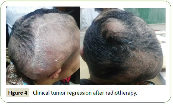 neurology-neuroscience-radiotherapy