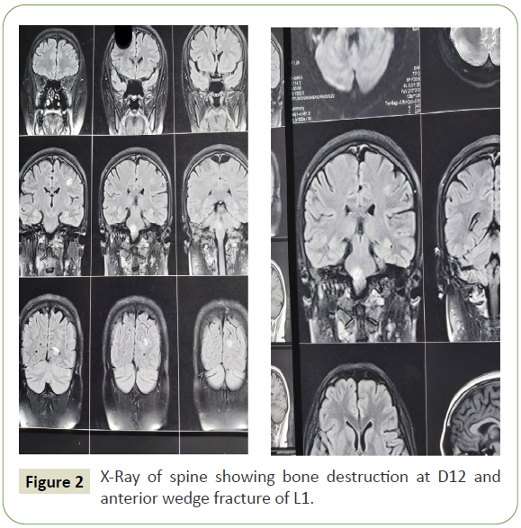 neurology-neuroscience-spine