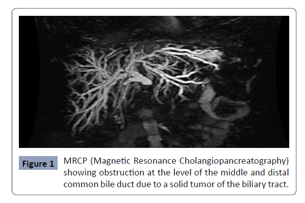 Health-Science-journal-MRCP