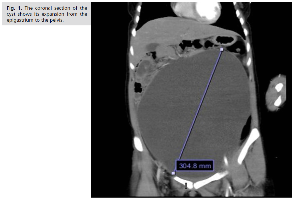 archives-medicine-coronal-section