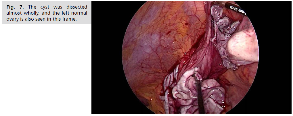 archives-medicine-ovary