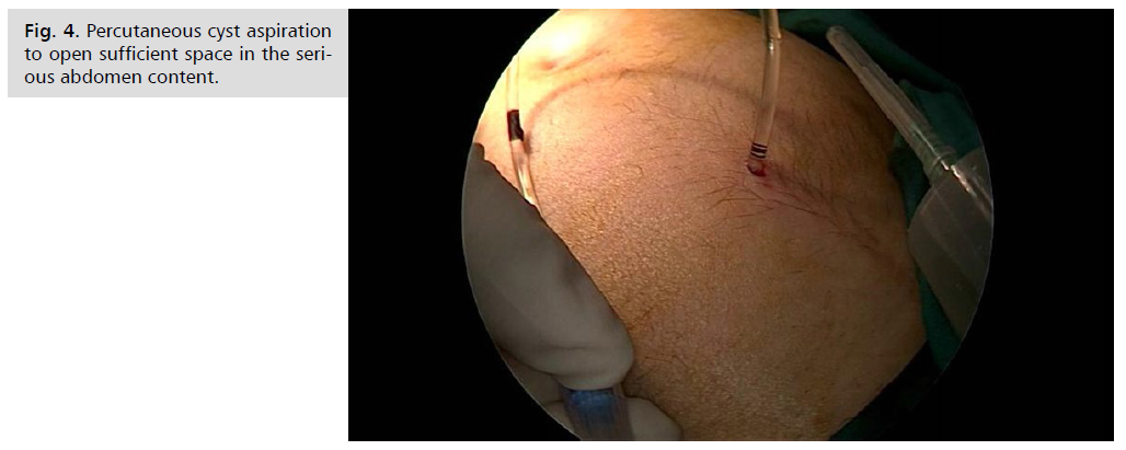 archives-medicine-percutaneous