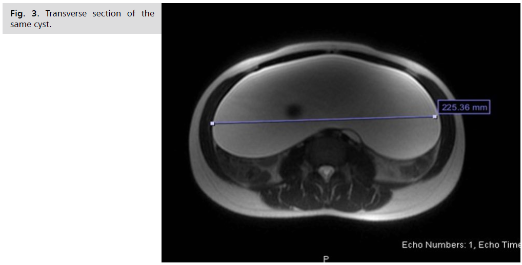 archives-medicine-transverse-section