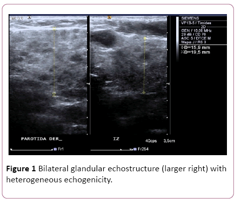 Annals-Clinical-Laboratory-Bilateral-glandular