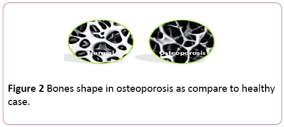 Annals-Clinical-Laboratory-Bones-shape