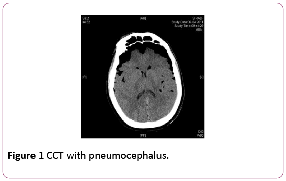 Annals-Clinical-Laboratory-CCT-pneumocephalus