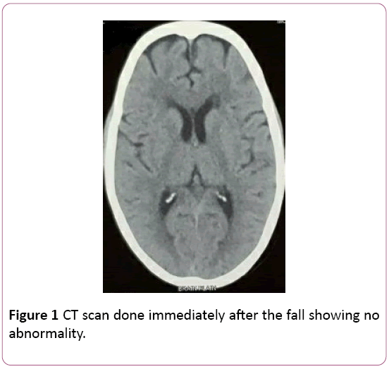 Annals-Clinical-Laboratory-CT-scan