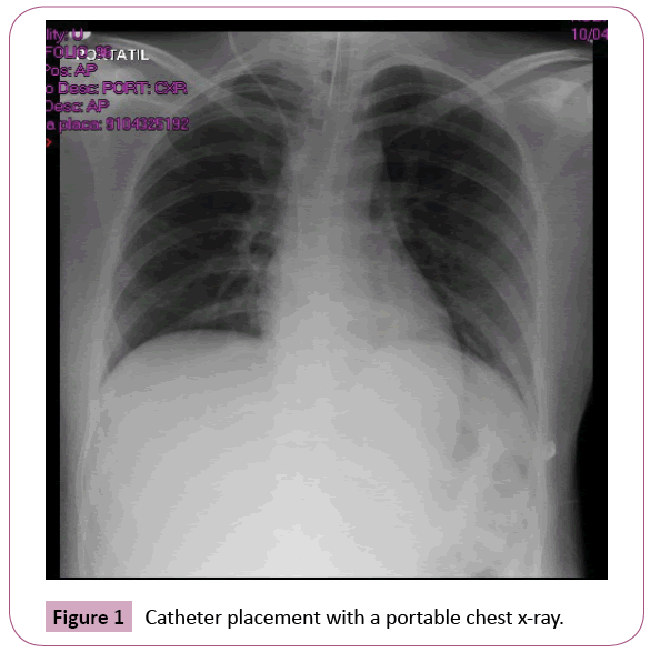 Annals-Clinical-Laboratory-Catheter-placement