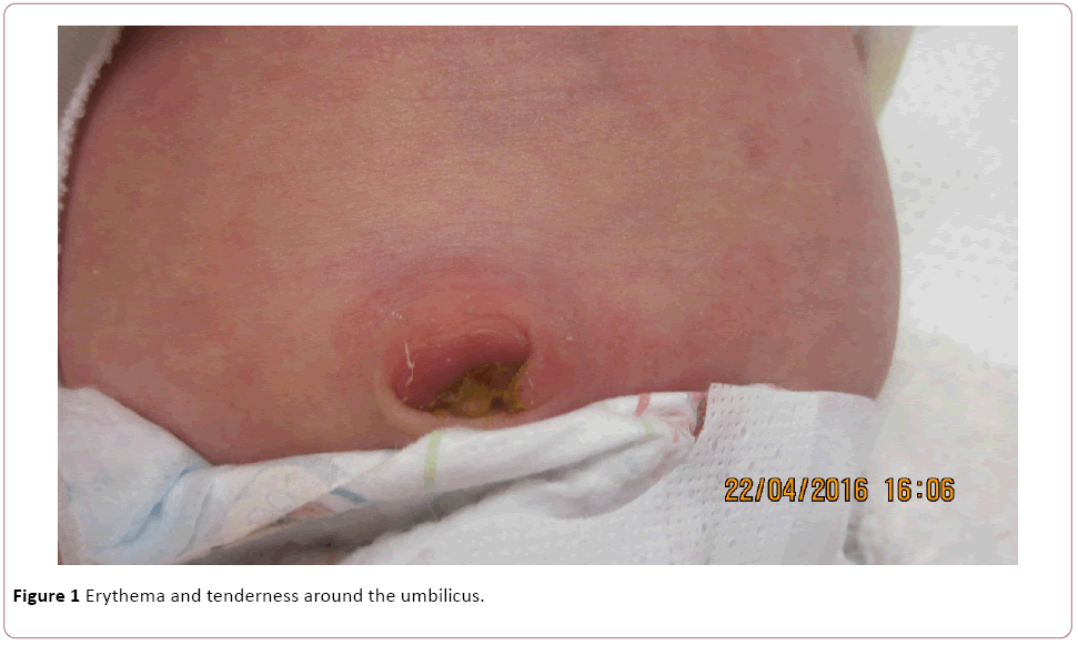 Annals-Clinical-Laboratory-Erythema-tenderness