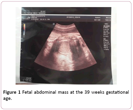 Annals-Clinical-Laboratory-Fetal-abdominal