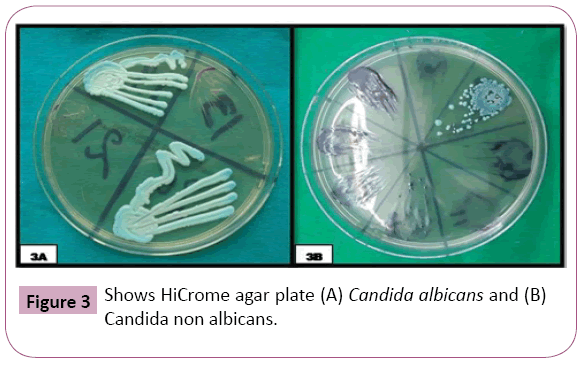 Annals-Clinical-Laboratory-HiCrome-agar