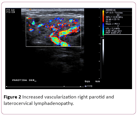 Annals-Clinical-Laboratory-Increased-vascularization