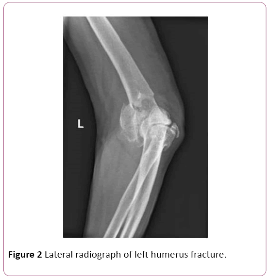 Annals-Clinical-Laboratory-Lateral-radiograph