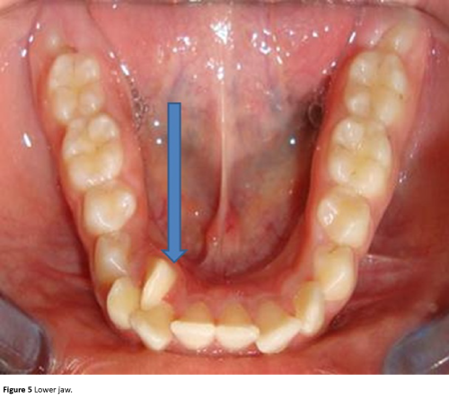Annals-Clinical-Laboratory-Lower-jaw
