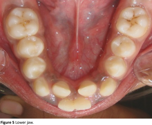 Annals-Clinical-Laboratory-Lower-jaw