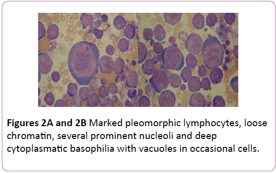 Annals-Clinical-Laboratory-Marked-pleomorphic