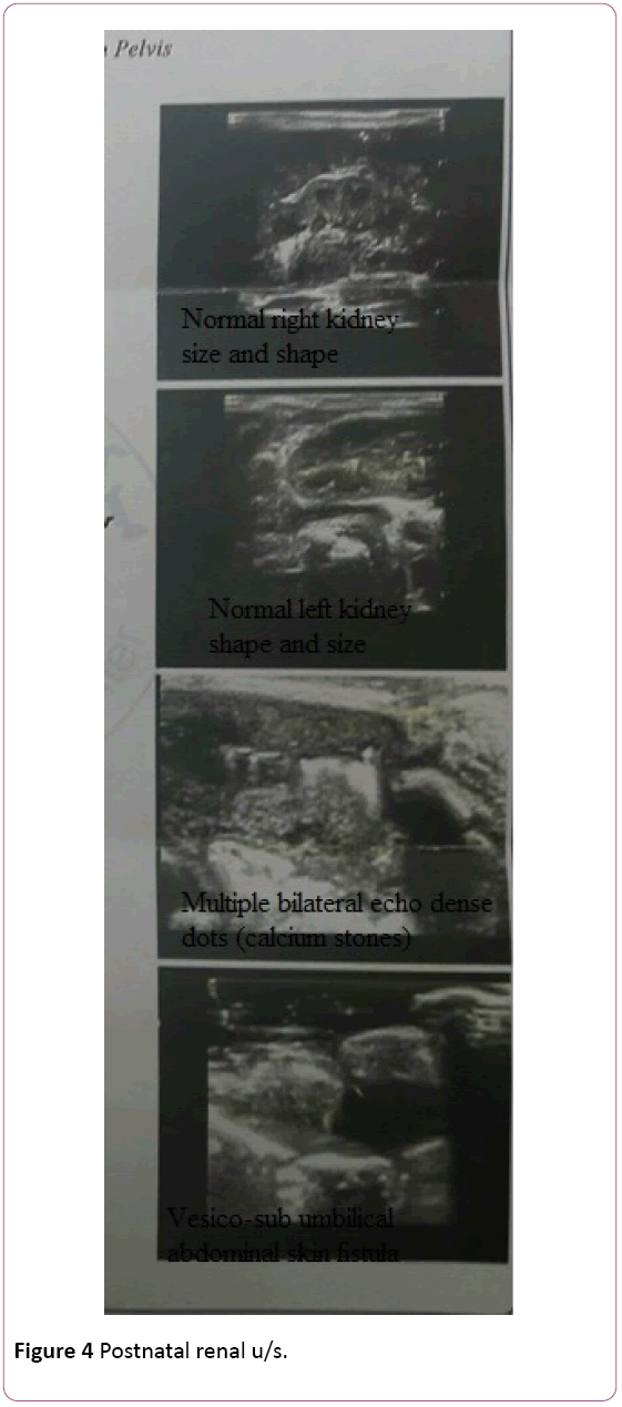 Annals-Clinical-Laboratory-Postnatal-renal