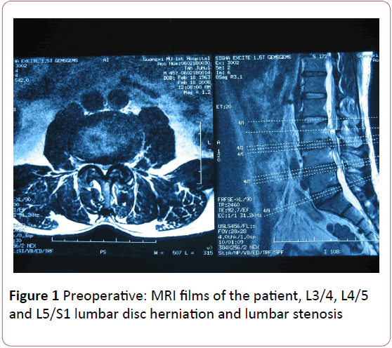 Annals-Clinical-Laboratory-Research-Preoperative-films-patient