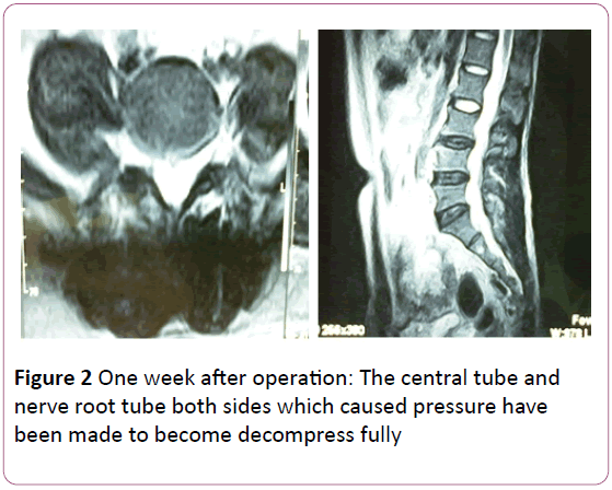 Annals-Clinical-Laboratory-Research-operation-root-decompress