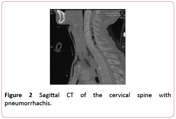 Annals-Clinical-Laboratory-Sagittal-CT