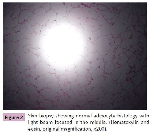 Annals-Clinical-Laboratory-Skin-biopsy